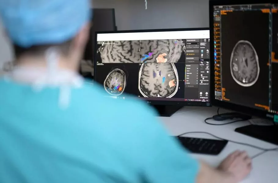 این هوش مصنوعی در 10 ثانیه بخشهای باقیمانده از تومور مغزی را حین جراحی تشخیص میدهد این هوش مصنوعی در 10 ثانیه بخشهای باقیمانده از تومور مغزی را حین جراحی تشخیص میدهد