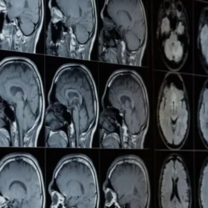 مایکروسافت هوش مصنوعی جدیدی برای تشخیص بیماری‌ها ازجمله سرطان معرفی کرد