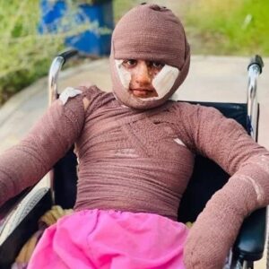 «هدا»، دختری از میناب/ مستندی درباره یکی از بازماندگان جنگ رمضان